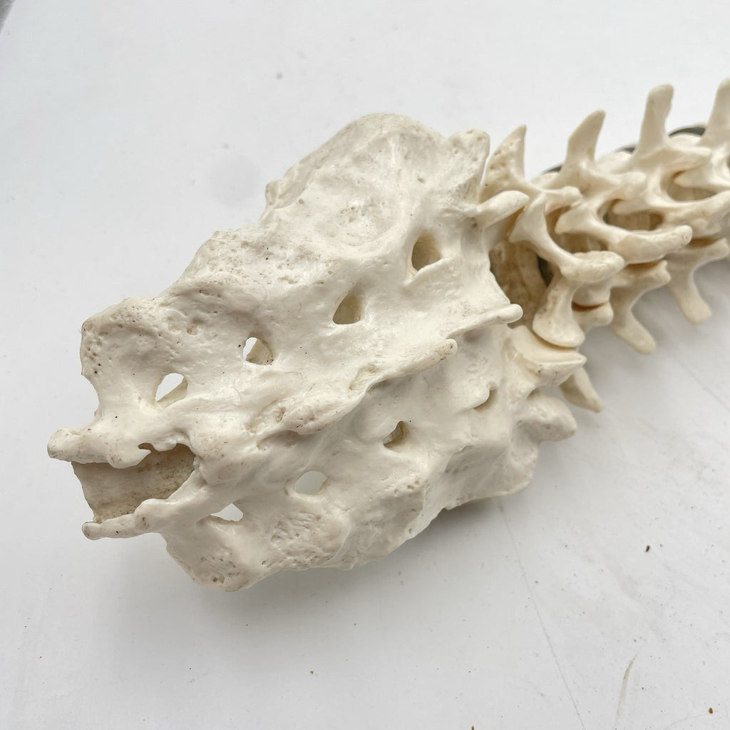 Adam Rouilly Spine Model with Skull Base Medical Anatomical Teaching Aid 1990s