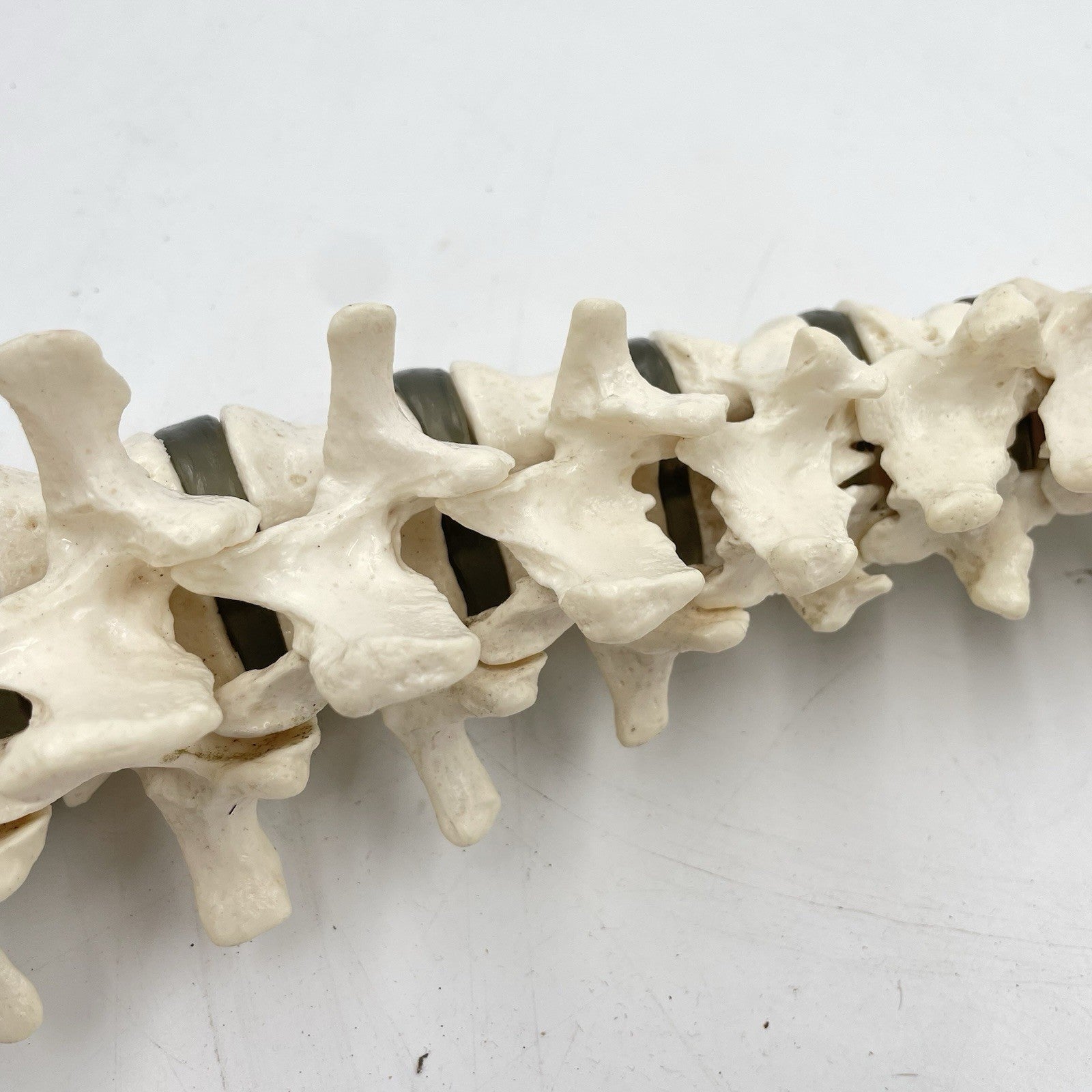 Adam Rouilly Spine Model with Skull Base Medical Anatomical Teaching Aid 1990s