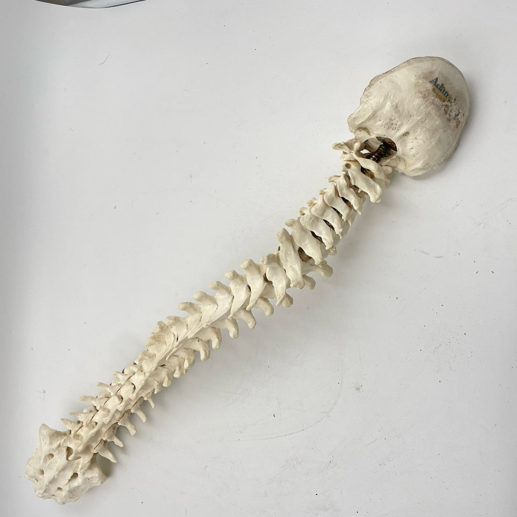 Adam Rouilly Spine Model with Skull Base Medical Anatomical Teaching Aid 1990s