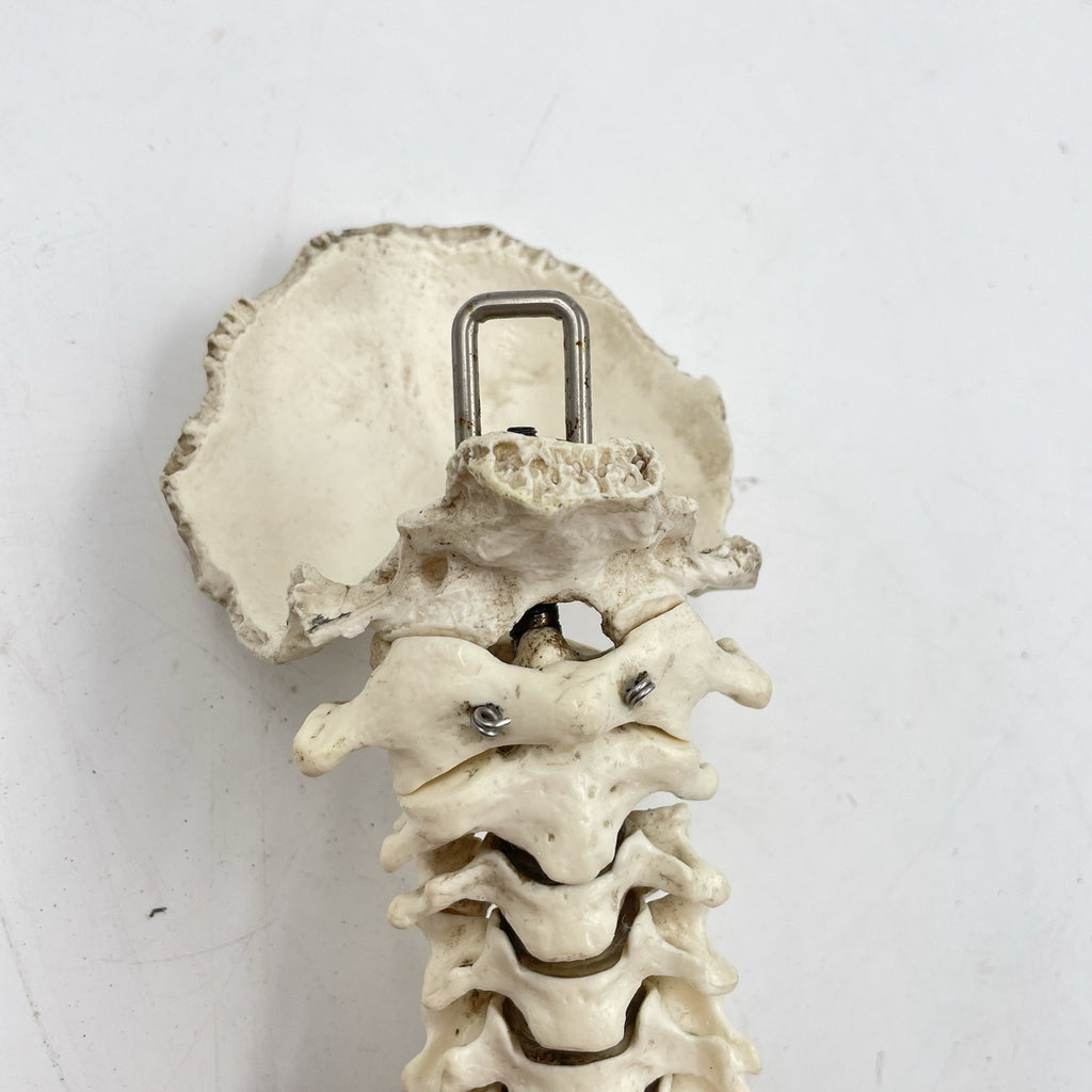 Adam Rouilly Spine Model with Skull Base Medical Anatomical Teaching Aid 1990s