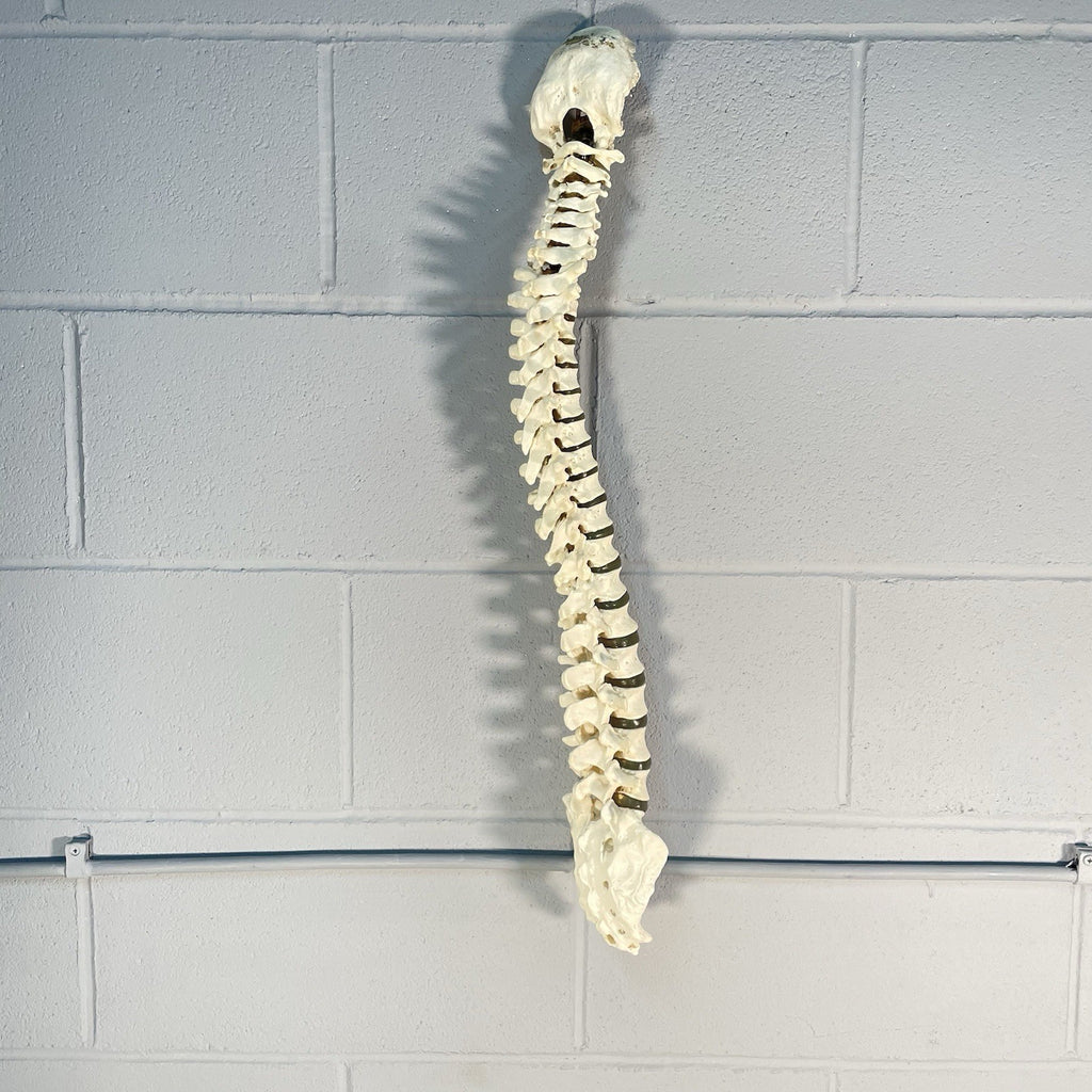 Adam Rouilly Spine Model with Skull Base Medical Anatomical Teaching Aid 1990s