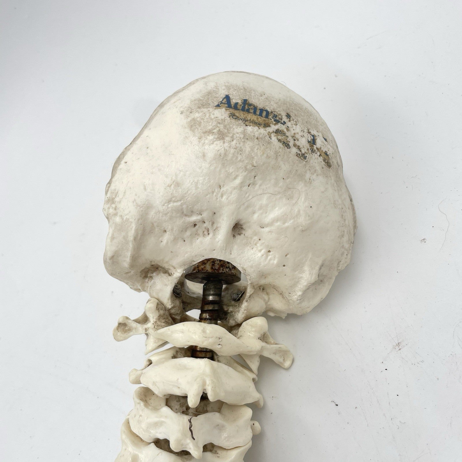 Adam Rouilly Spine Model with Skull Base Medical Anatomical Teaching Aid 1990s